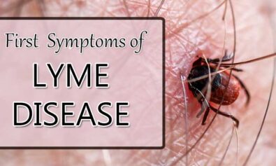 first symptoms of lyme disease