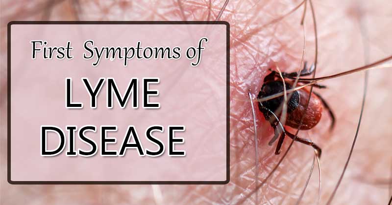 first symptoms of lyme disease