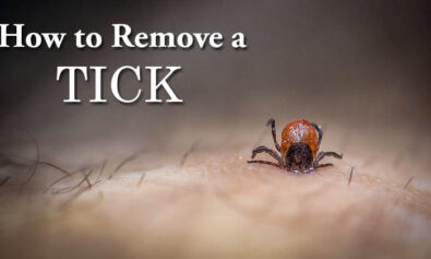 how to remove a tick