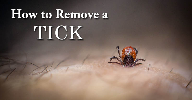 how to remove a tick