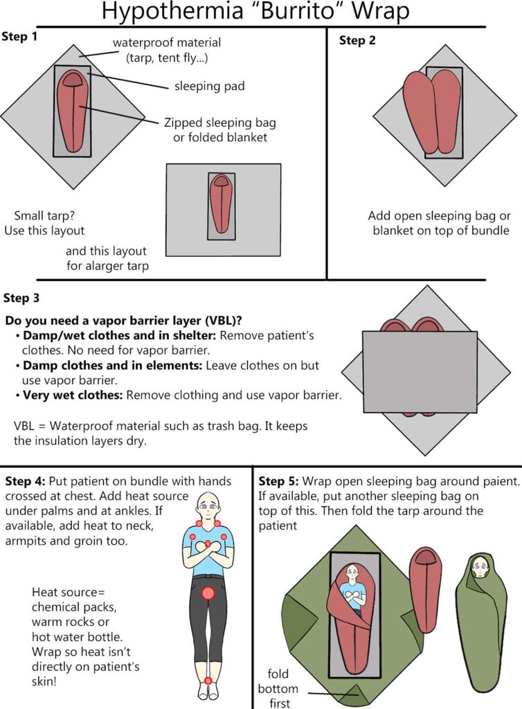 hypothermia wrap instructions infographic